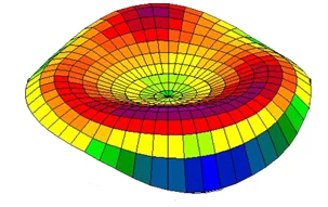 Topography-Guided LASIK at Liberty Laser Eye Center